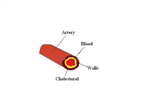 Your arteries with the normal level of cholesterol