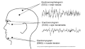 Placement of electrodes to determine EEG, EOG, and EMG