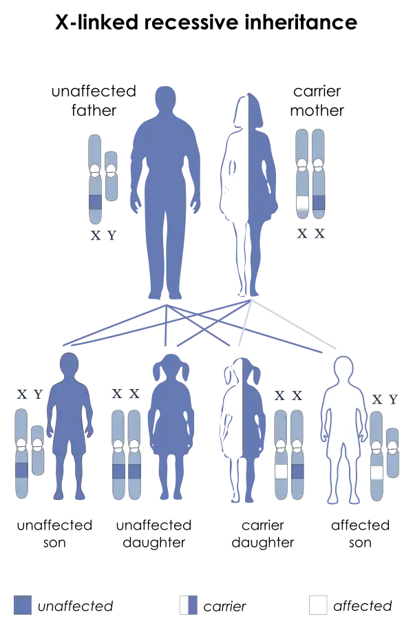 X-linked recessive inheritance